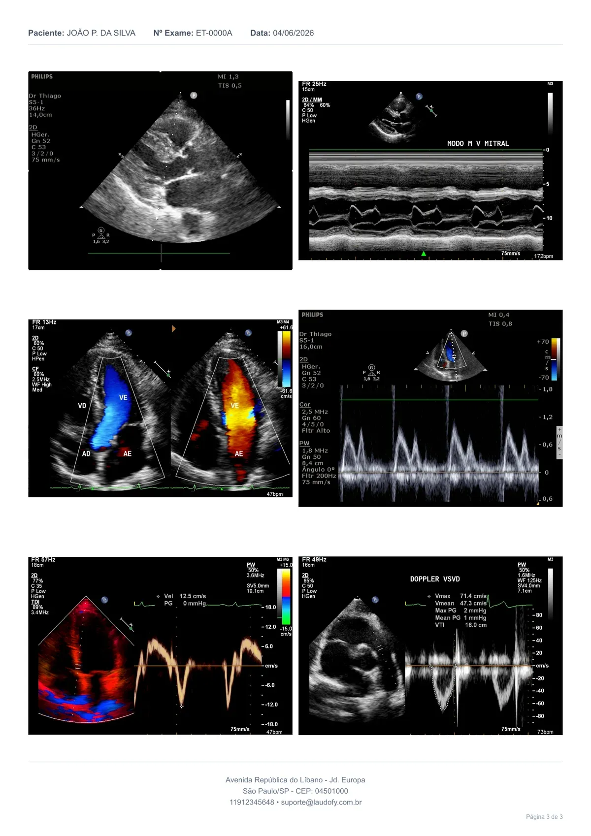 Página 3 do laudo: imagens do ecocardiograma